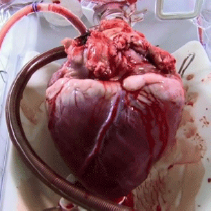 Coeur humain